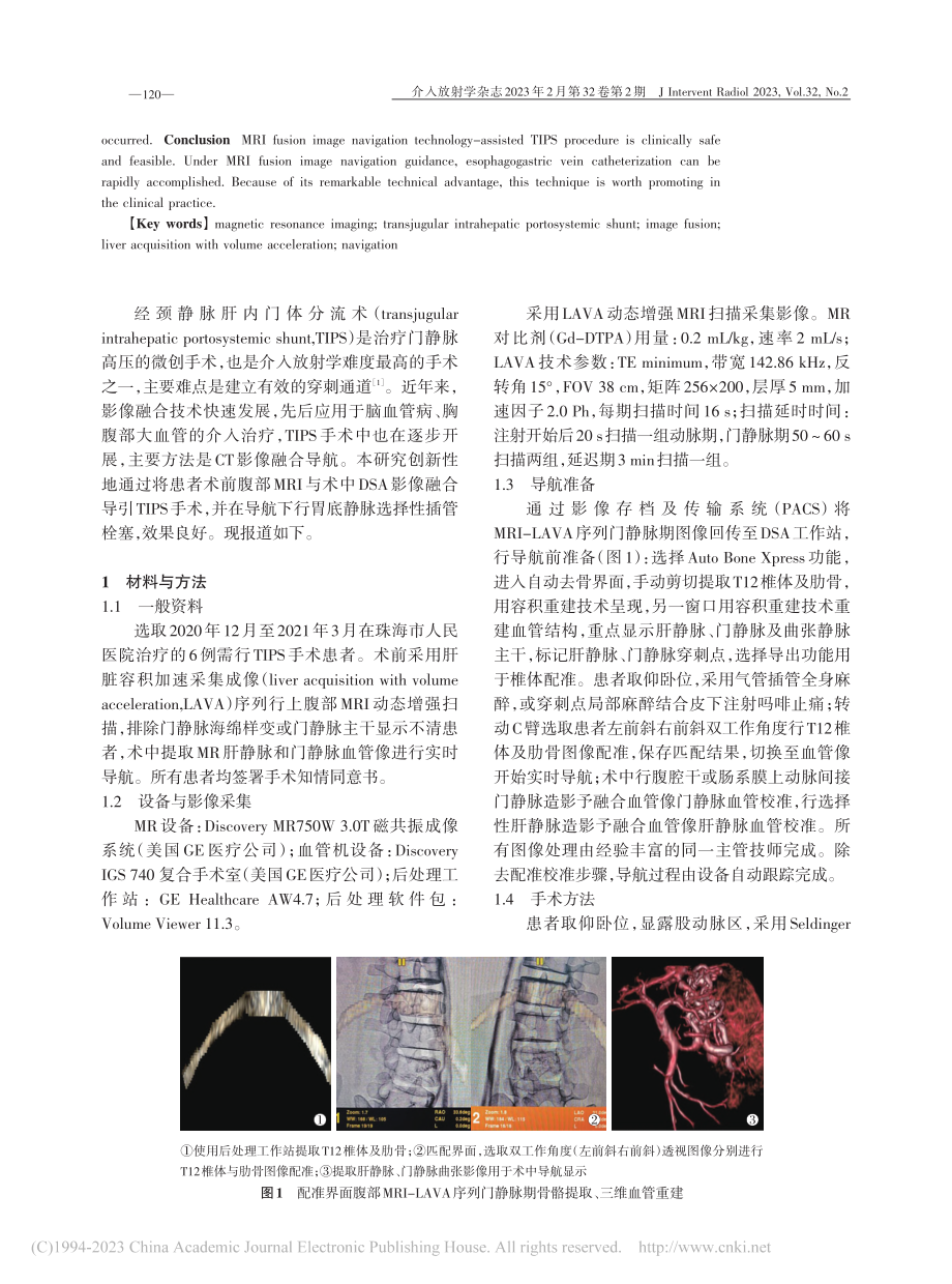 MRI融合导航经颈静脉肝内门体分流术的临床优势和经验_安涛.pdf_第2页