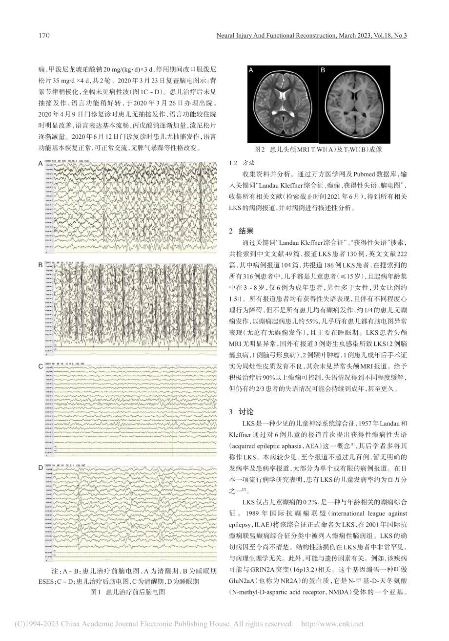 Landau-Kleffn...r综合征一例报道并文献复习_徐蓉.pdf_第2页