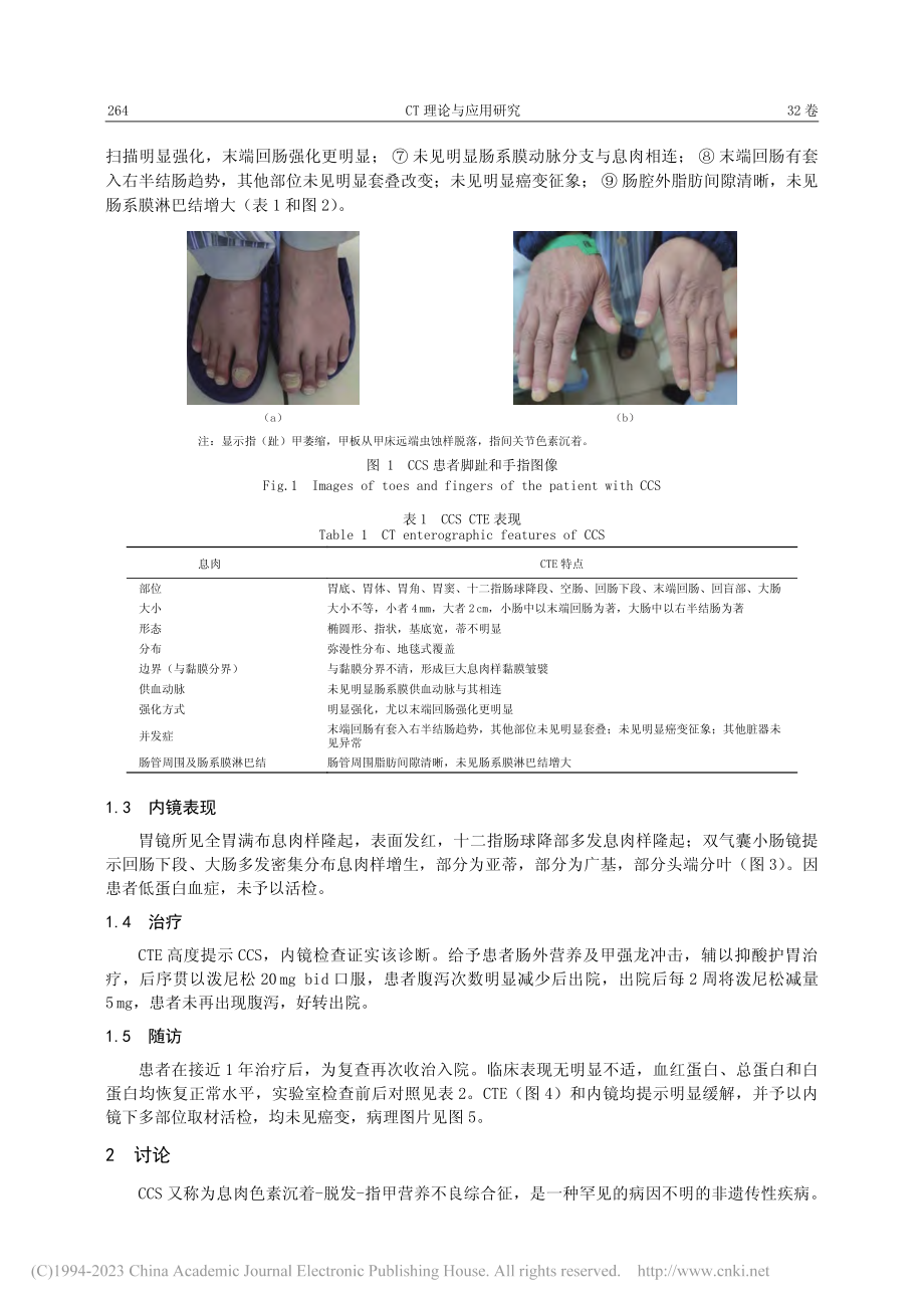 CT小肠造影诊断Cronk...nada综合征临床案例分析_赵雪松.pdf_第2页