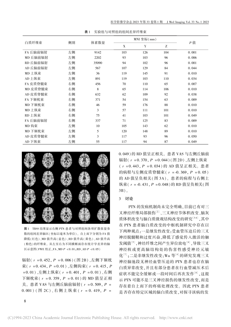 基于TBSS的右侧原发性三叉神经痛患者脑白质损伤研究_陈方方.pdf_第3页