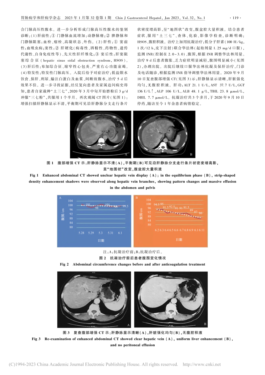 抗凝治疗土三七致肝窦阻塞综合征1例报道_陈慧群.pdf_第2页