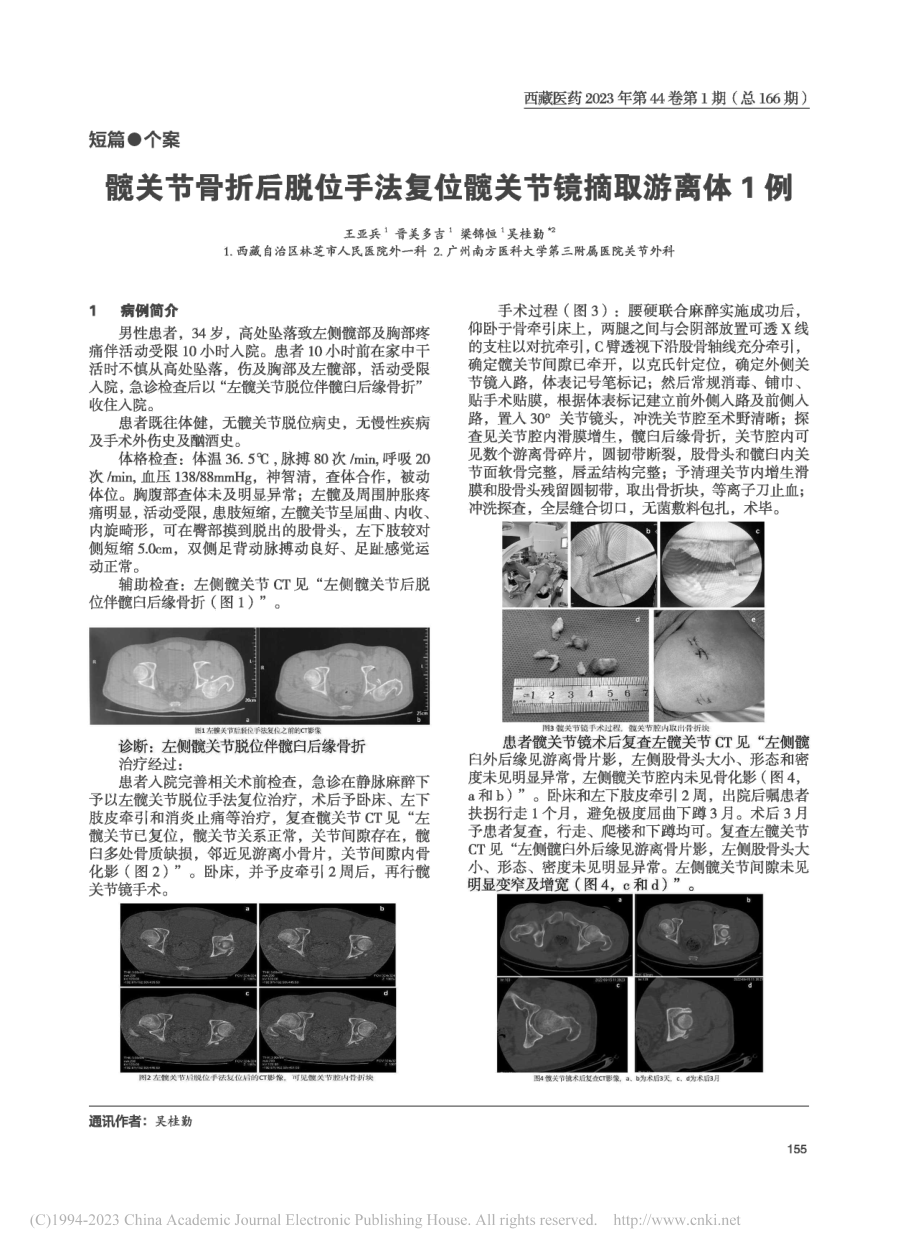 髋关节骨折后脱位手法复位髋关节镜摘取游离体1例_王亚兵.pdf_第1页