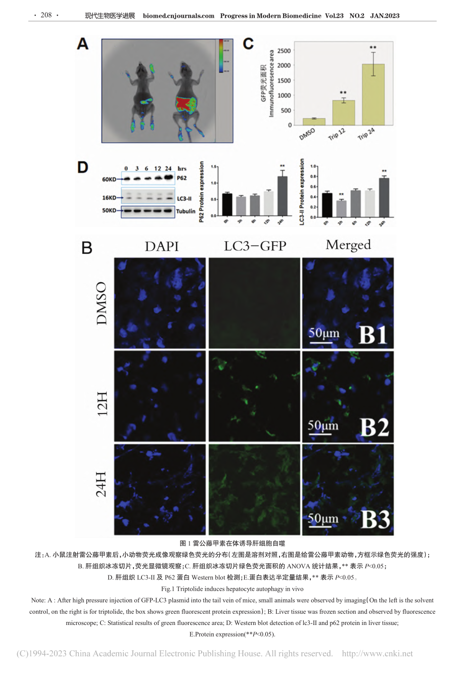 雷公藤甲素诱导肝细胞选择性自噬的形态学观察_蒋杨雨.pdf_第3页