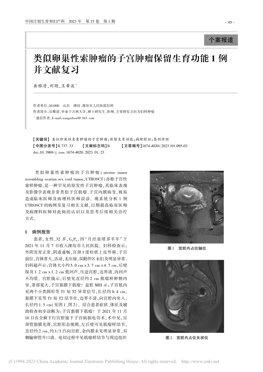 类似卵巢性索肿瘤的子宫肿瘤保留生育功能1例并文献复习_岳雅清.pdf_第1页