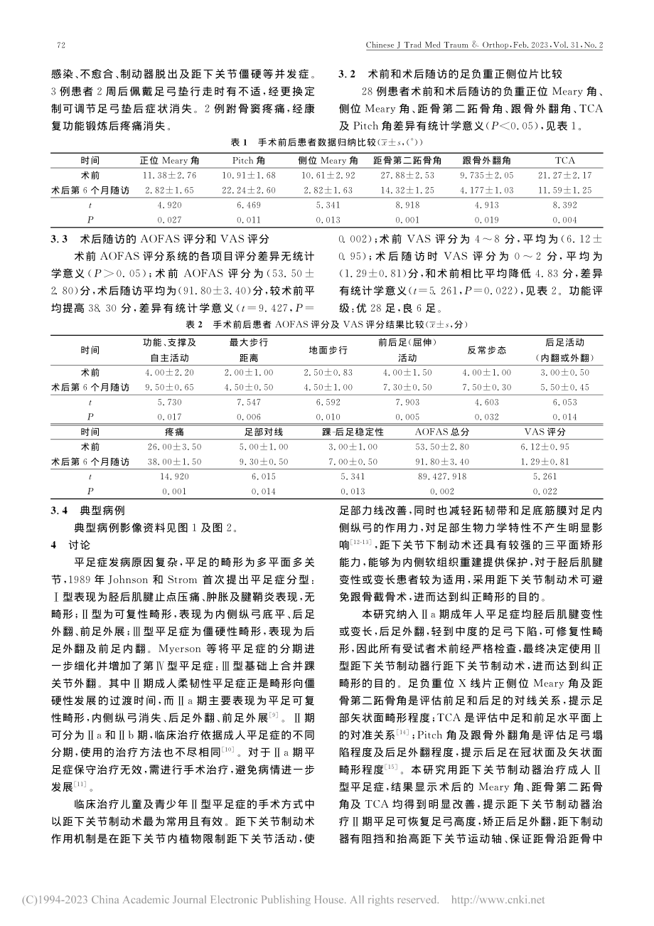 距下关节制动术治疗成人柔性平足症28例_赵廷虎.pdf_第3页