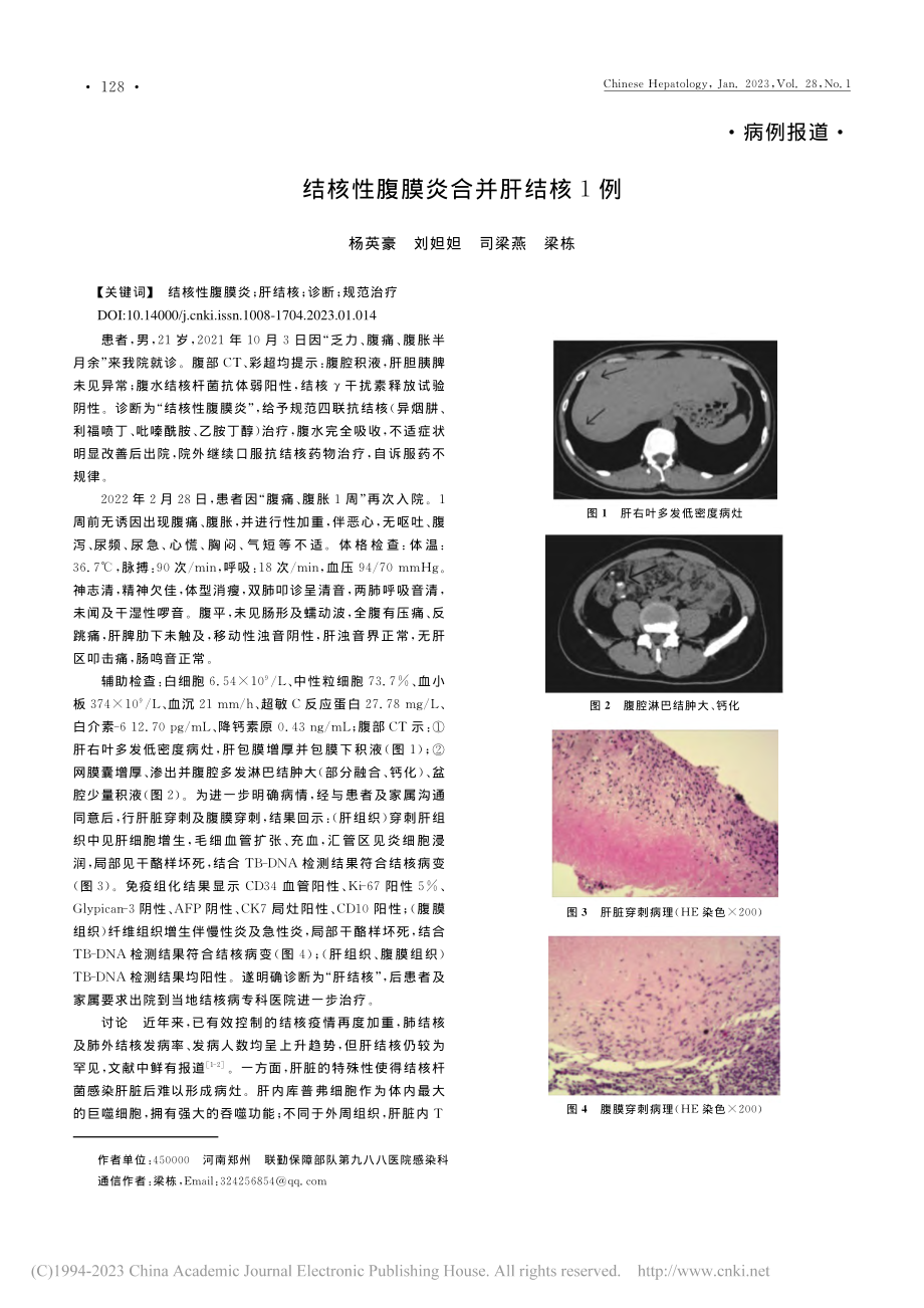 结核性腹膜炎合并肝结核1例_杨英豪.pdf_第1页