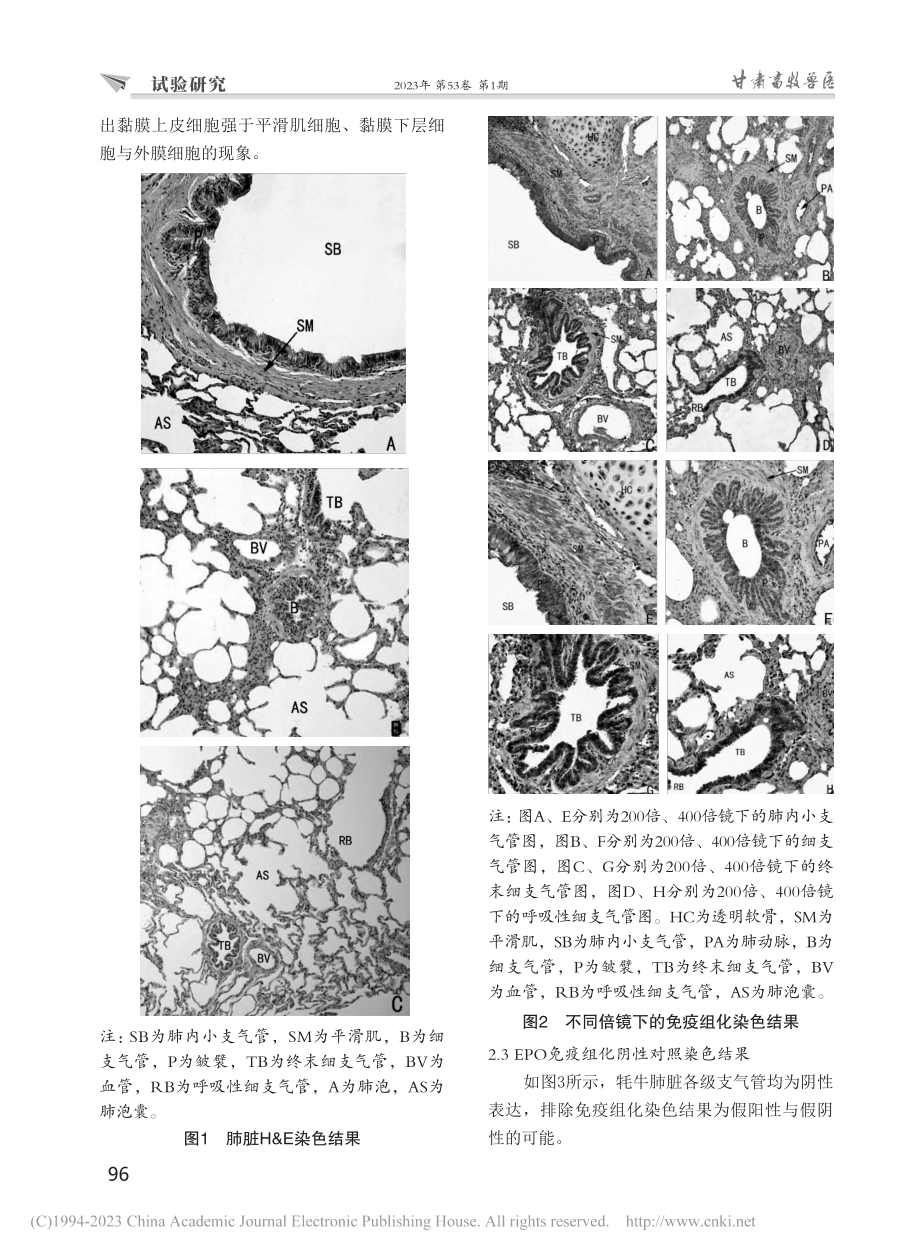 牦牛肺脏各支气管中EPO的表达差异研究_杨映雪.pdf_第3页