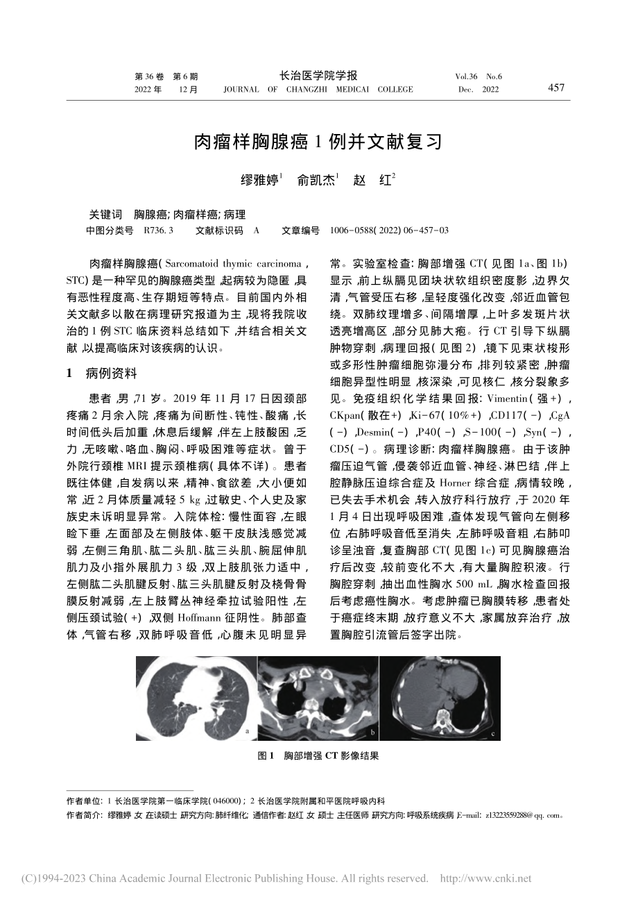 肉瘤样胸腺癌1例并文献复习_缪雅婷.pdf_第1页