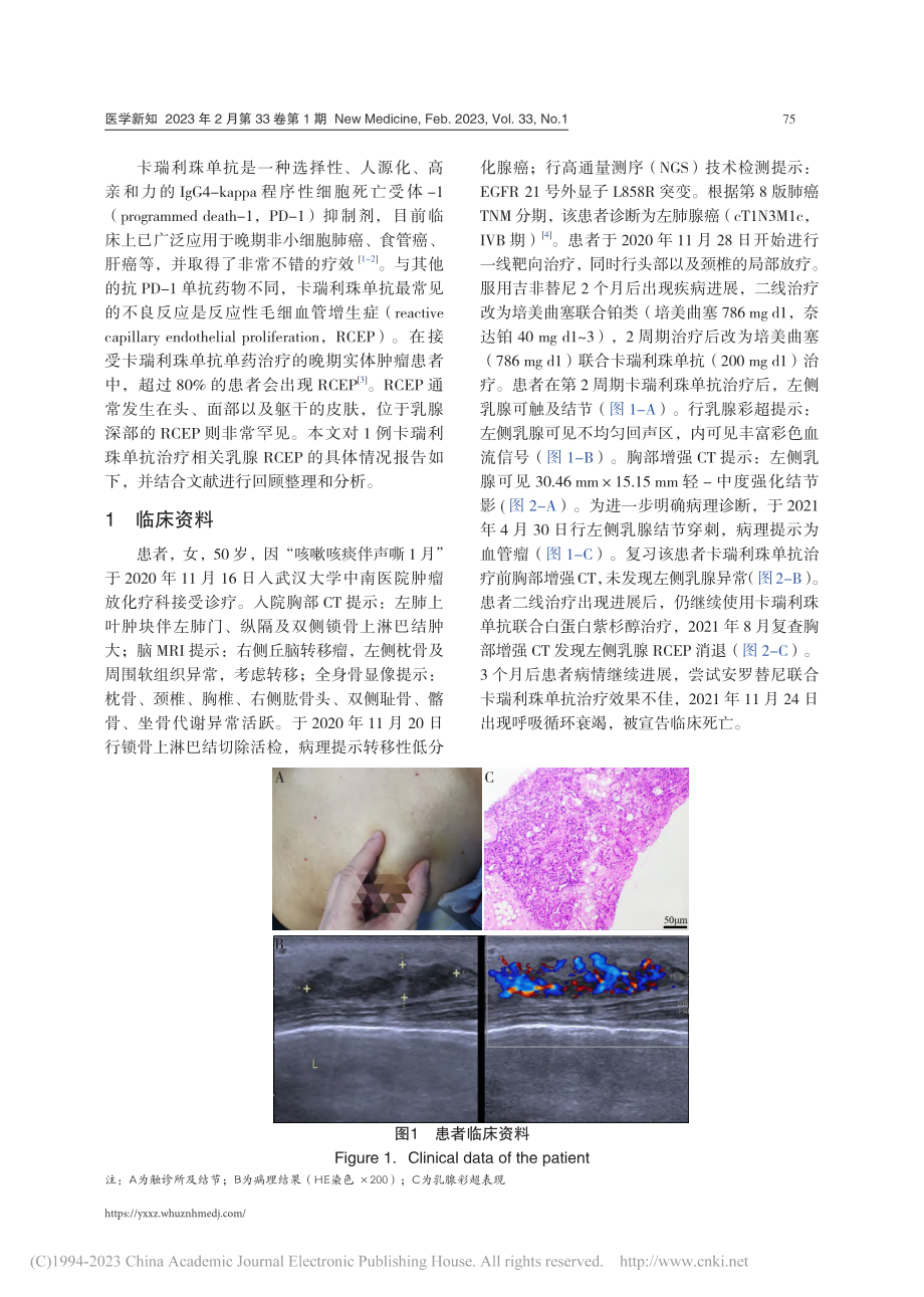 免疫治疗相关乳腺反应性毛细血管增生症1例_揭晨.pdf_第2页