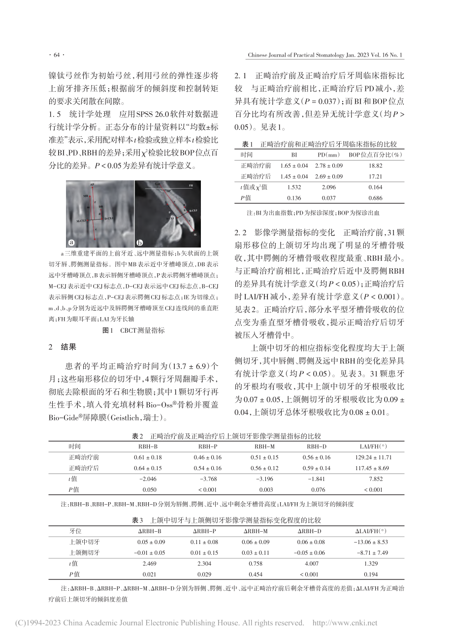 上颌切牙扇形移位的牙周-正畸联合治疗效果研究_李静雯.pdf_第3页