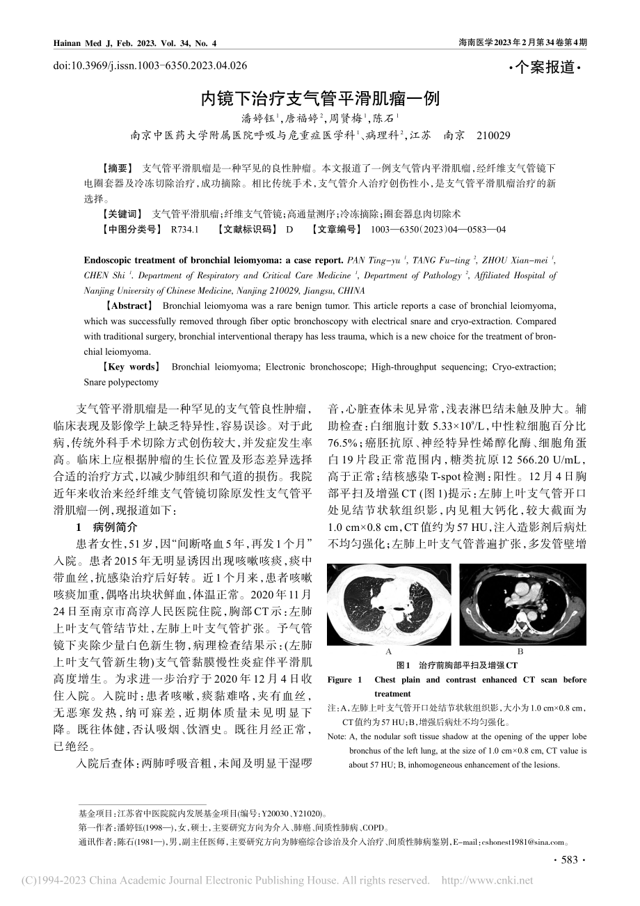 内镜下治疗支气管平滑肌瘤一例_潘婷钰.pdf_第1页