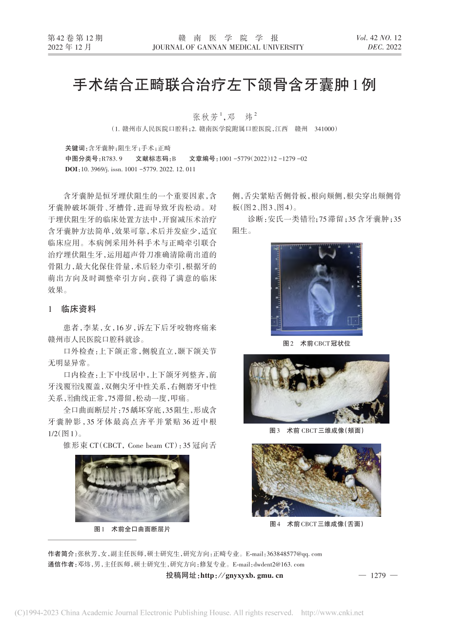 手术结合正畸联合治疗左下颌骨含牙囊肿1例_张秋芳.pdf_第1页