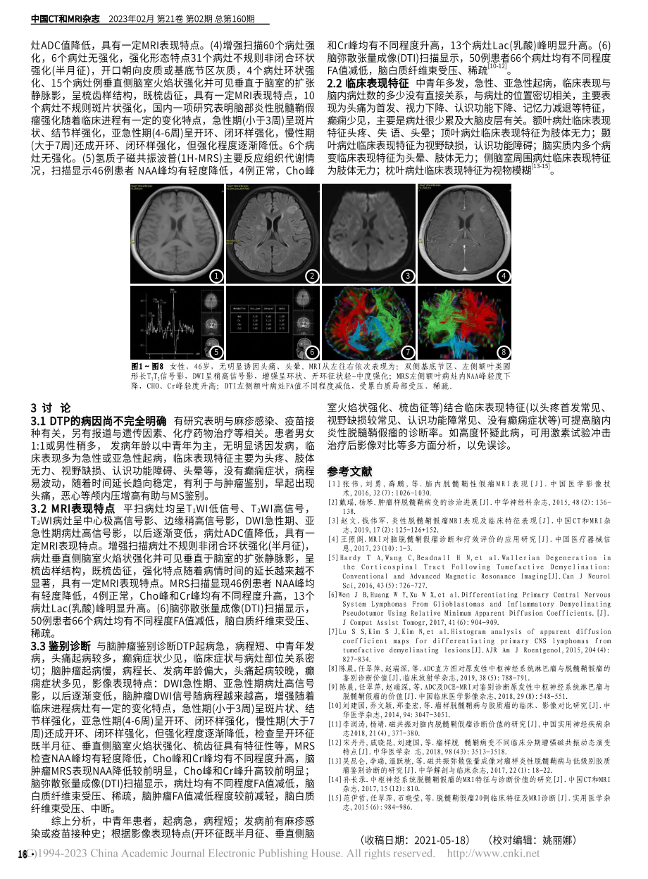 脑部炎性脱髓鞘假瘤MRI表...合临床特征对临床的诊断价值_赵文.pdf_第2页