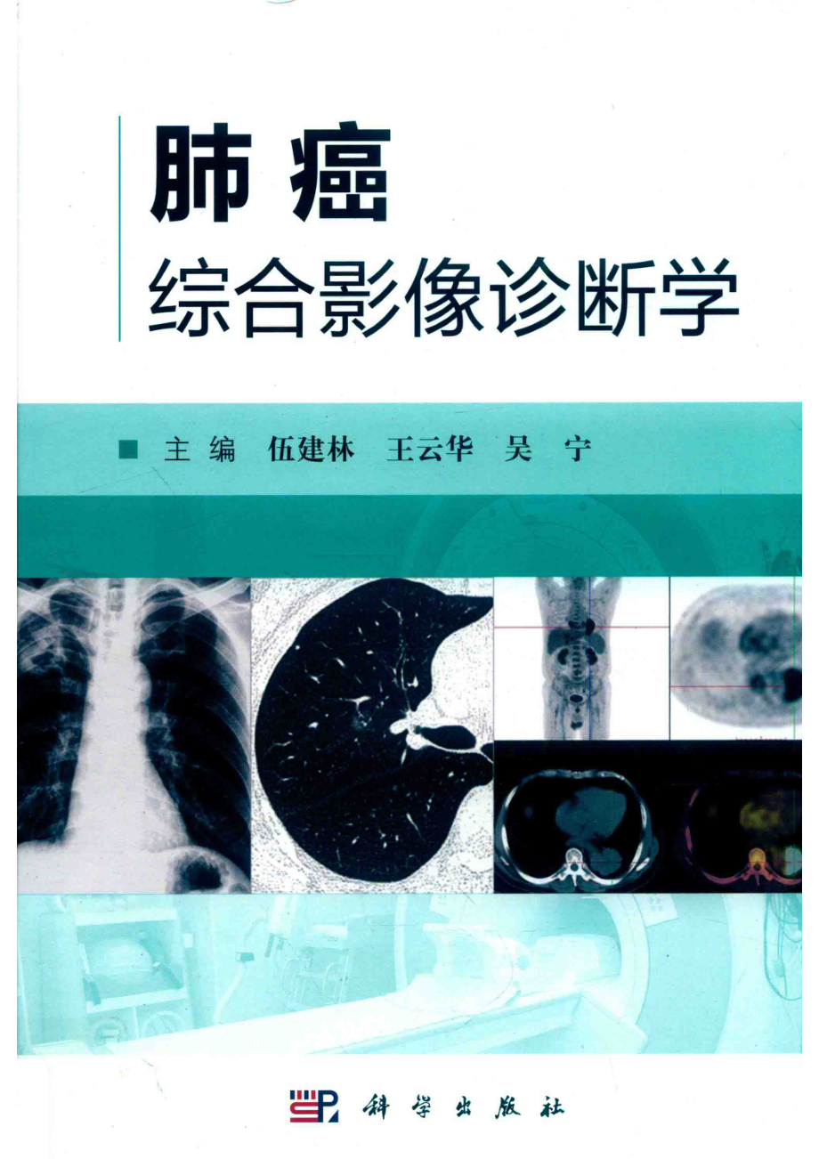 肺癌综合影像诊断学_14631960.pdf_第1页