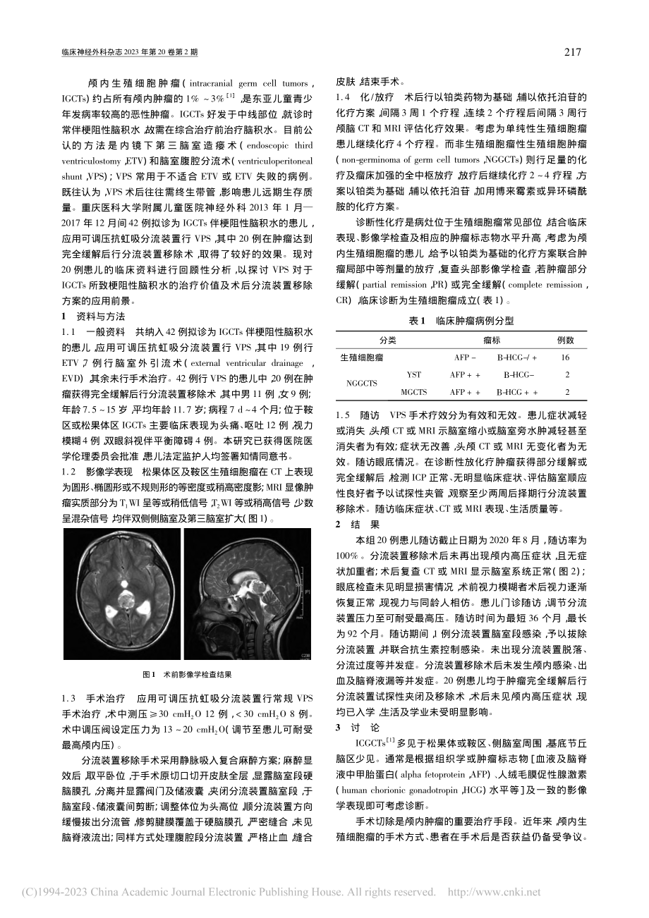 IGCTs所致梗阻性脑积水...期分流装置移除的可行性探讨_王立.pdf_第2页