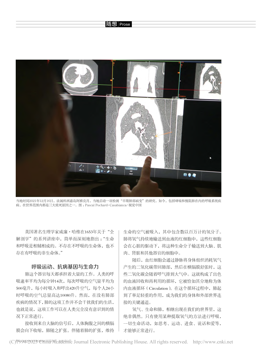 常被忽视的肺部疾病_迈克尔·J史蒂芬.pdf_第2页