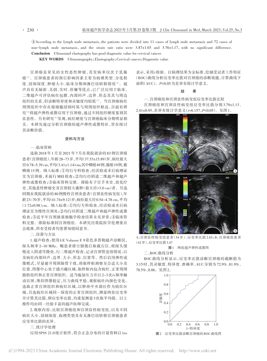 宫颈癌超声弹性成像特征及诊断价值分析_周春艳.pdf_第2页