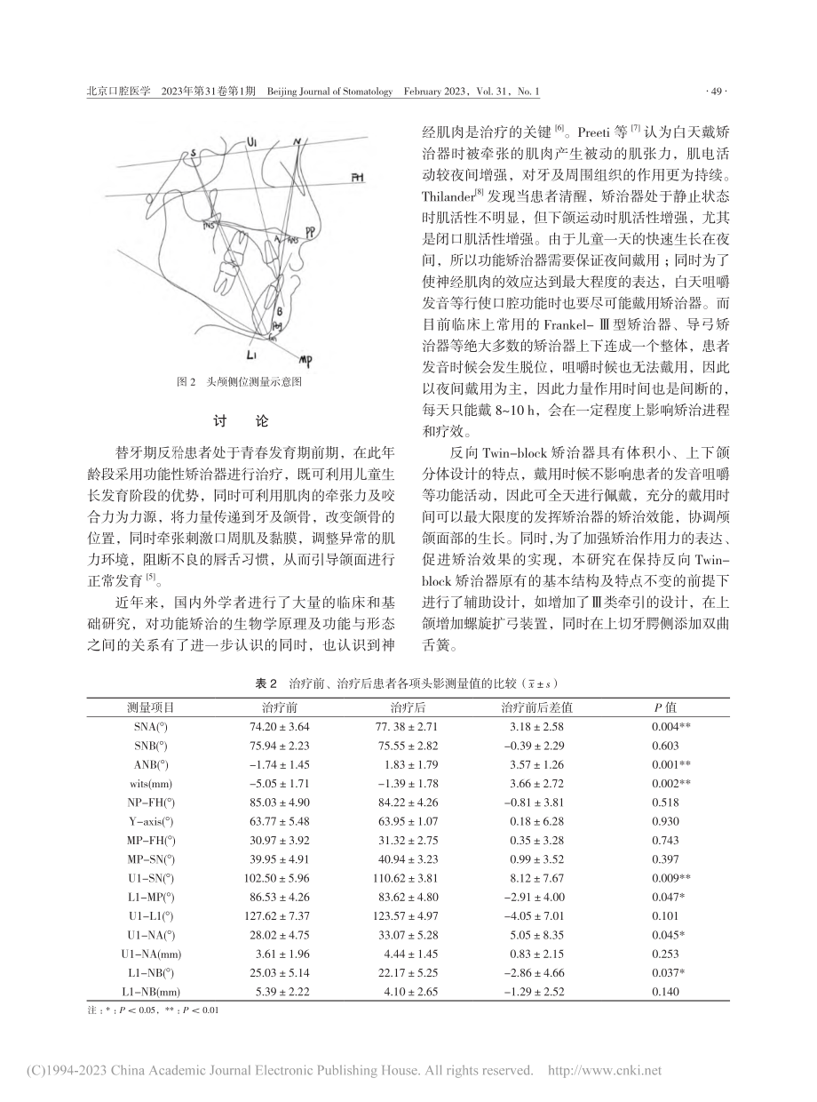 反向Twin-block矫...Ⅲ类错畸形的临床疗效观察_李安然.pdf_第3页