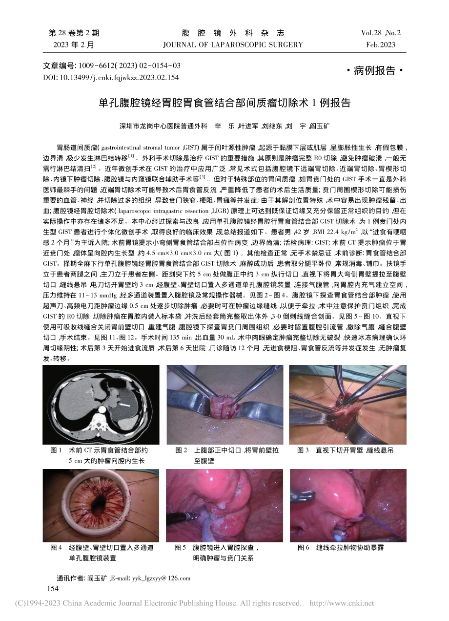 单孔腹腔镜经胃腔胃食管结合部间质瘤切除术1例报告_辛乐.pdf_第1页