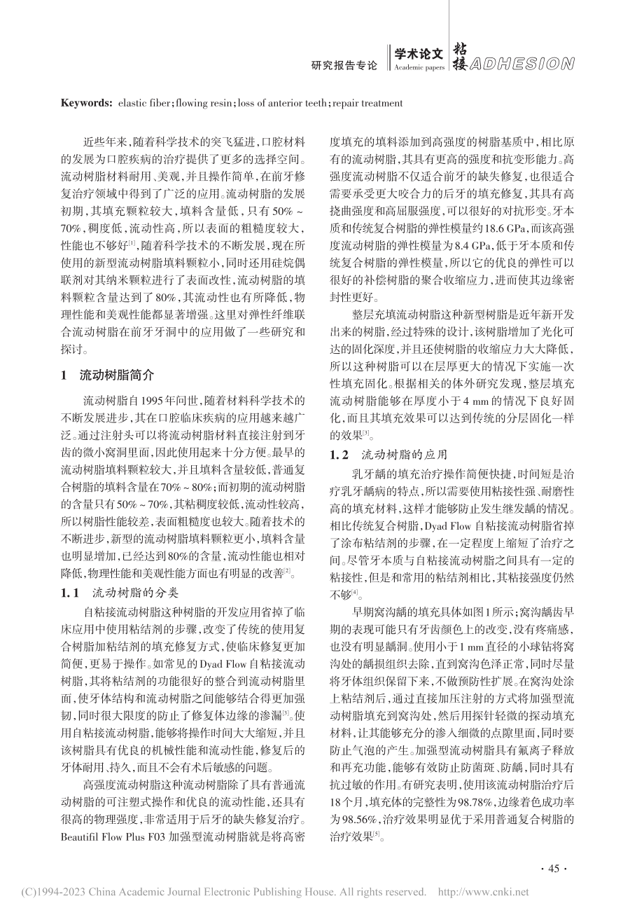 弹性纤维联合流动树脂在前牙缺失粘合修复中的应用_段丽娜.pdf_第2页