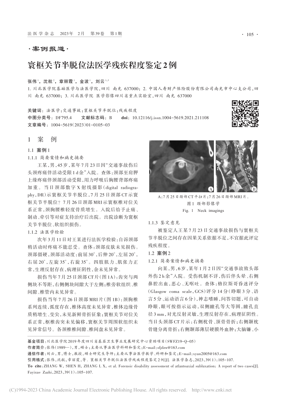 寰枢关节半脱位法医学残疾程度鉴定2例_张伟.pdf_第1页