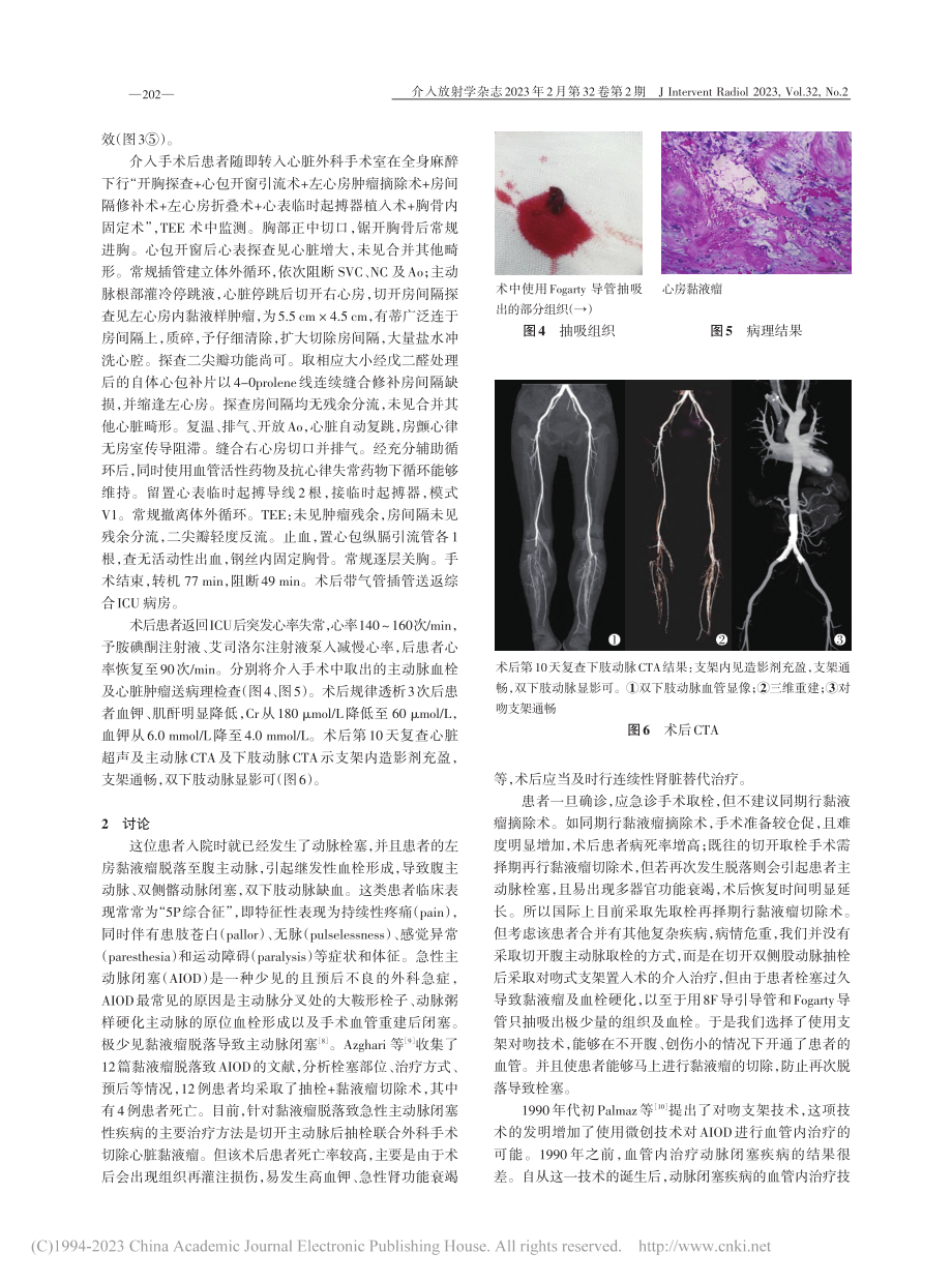 对吻支架置入术治疗心脏黏液...主动脉闭塞并横纹肌溶解1例_魏楠.pdf_第3页