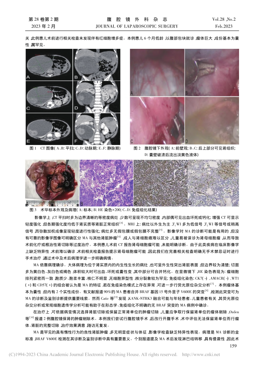 低龄后肾腺瘤1例报告_李中策.pdf_第2页