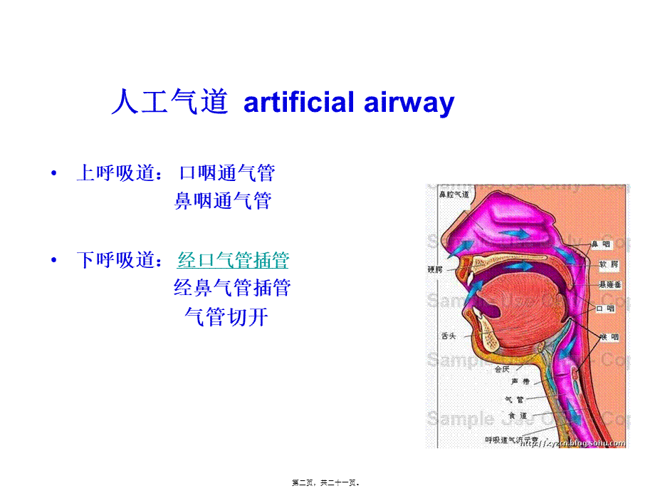 口咽通气管.pptx_第2页