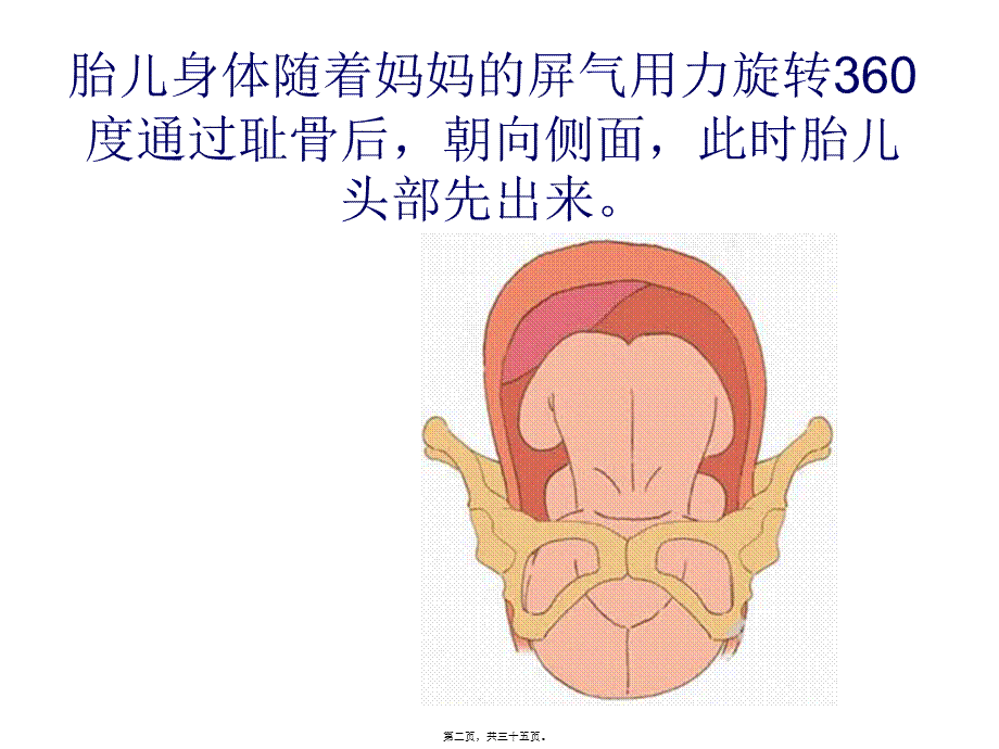 分娩图解.pptx_第2页