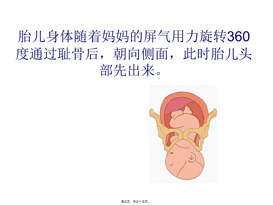 分娩图解.pptx_第3页