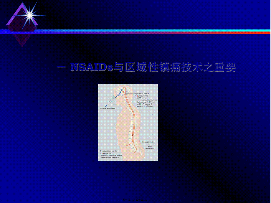 多模式镇痛新理念.pptx_第1页