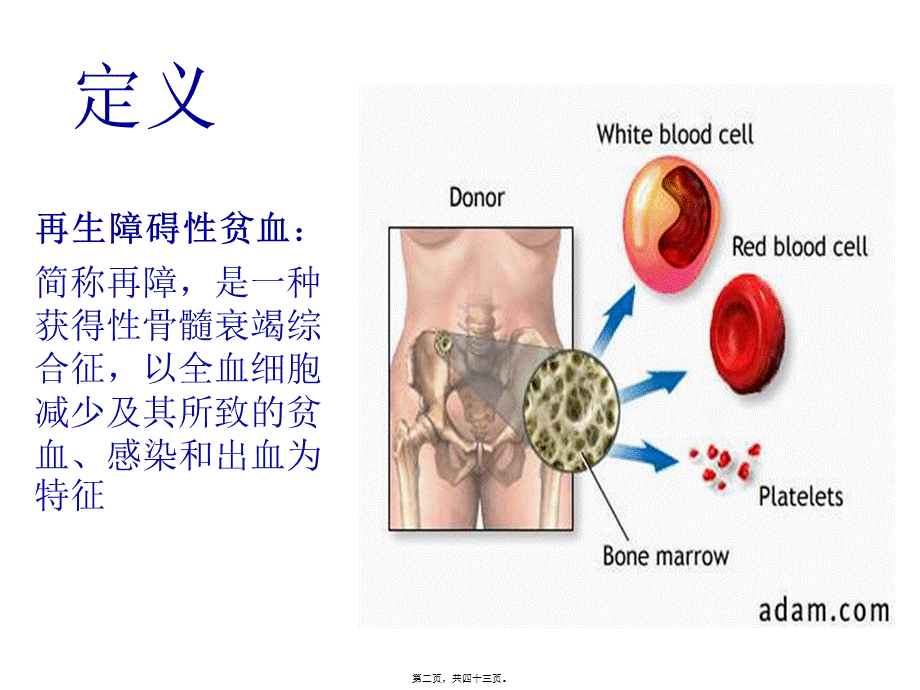 再生障碍性贫血(七年制).pptx_第2页