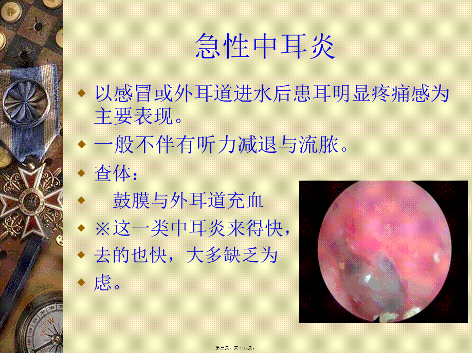 儿童中耳炎资料.pptx_第3页