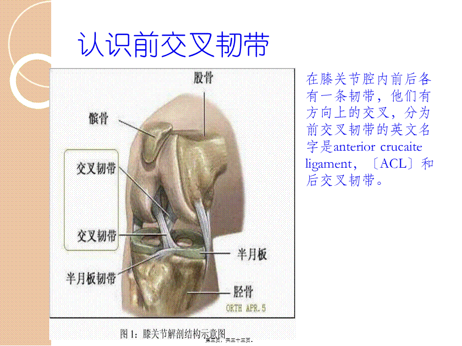 前叉韧带损伤的教学查房.pptx_第3页