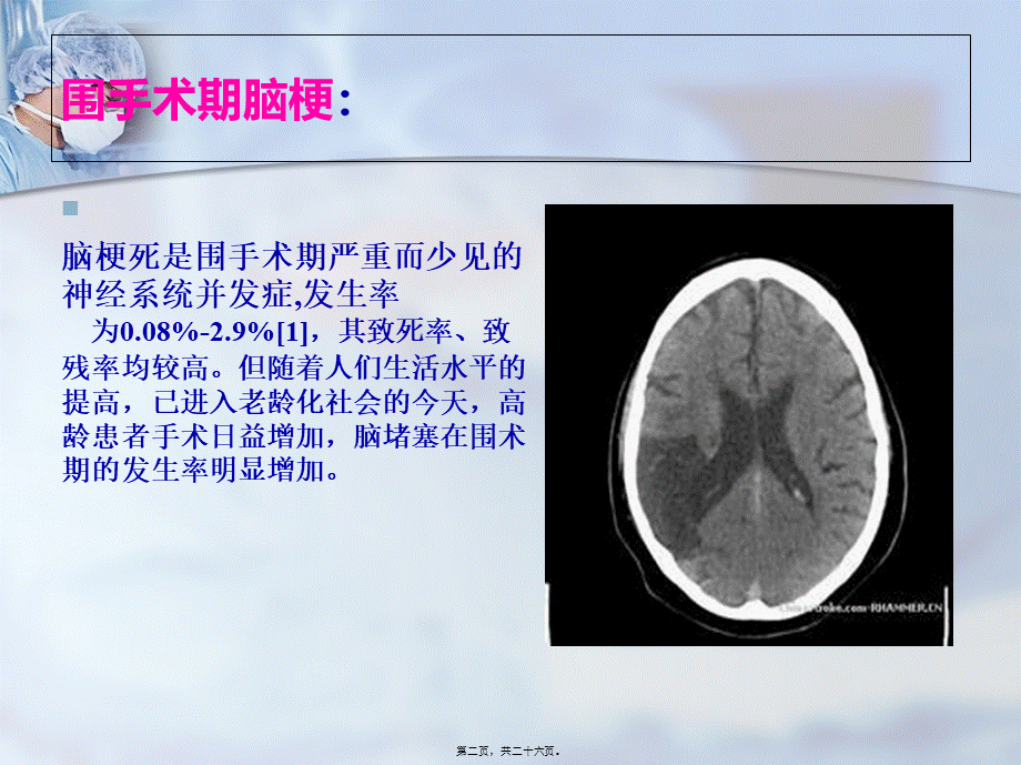 围手术期脑梗.pptx_第2页