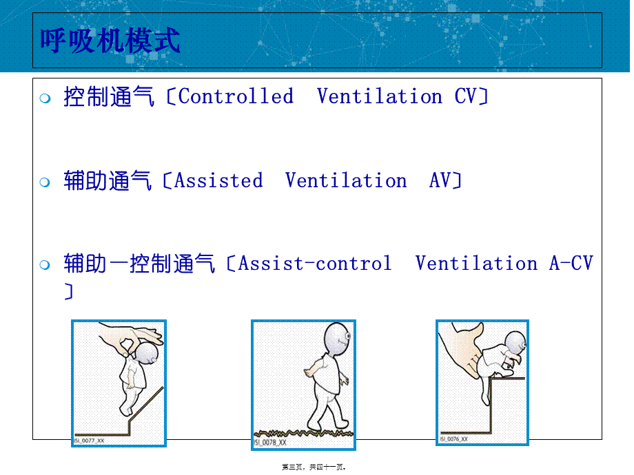 呼吸机常用参数及设置.pptx_第3页