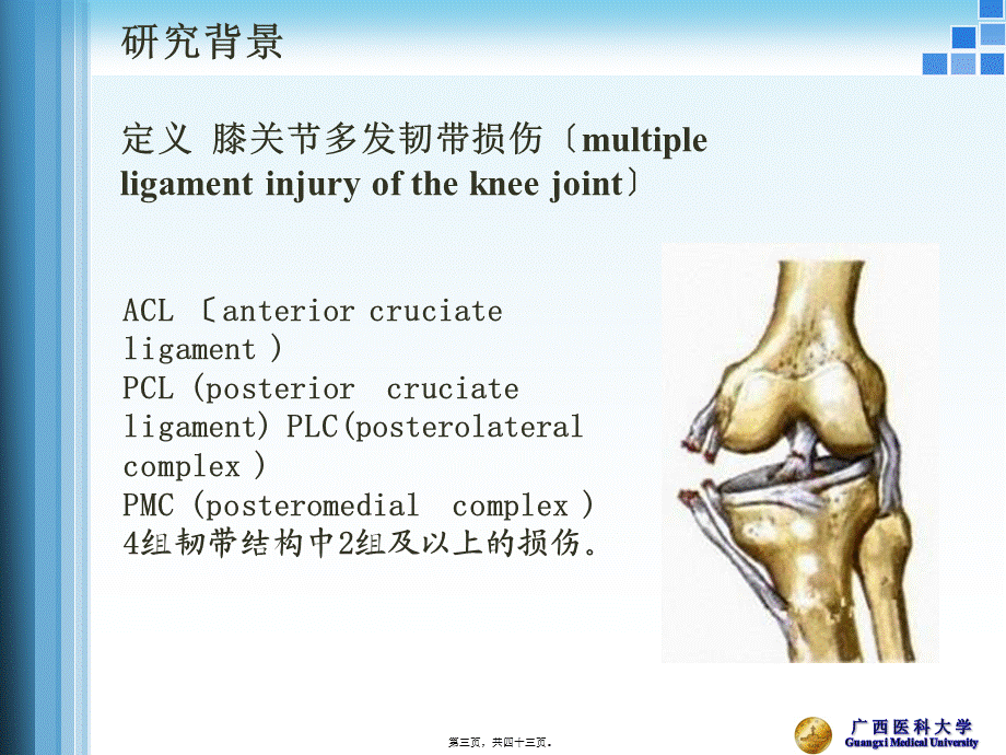 关节镜膝关节多发韧带损伤的修复.ppt_第3页