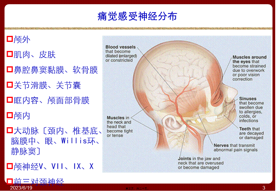 头痛与面部疼痛.pptx_第3页