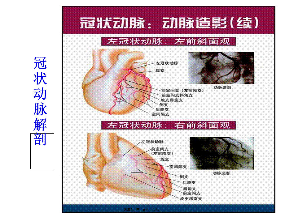 冠心病-2011.pptx_第3页