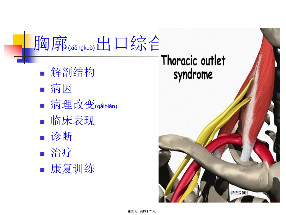 2022年医学专题—胸廓出口综合征.ppt_第3页