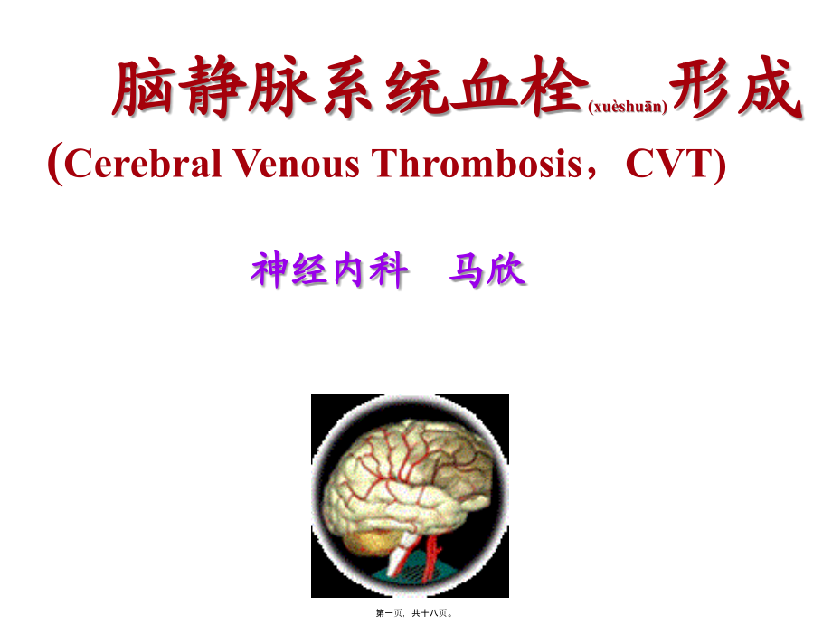 2022年医学专题—脑静脉系统血栓形成幻灯片.ppt_第1页