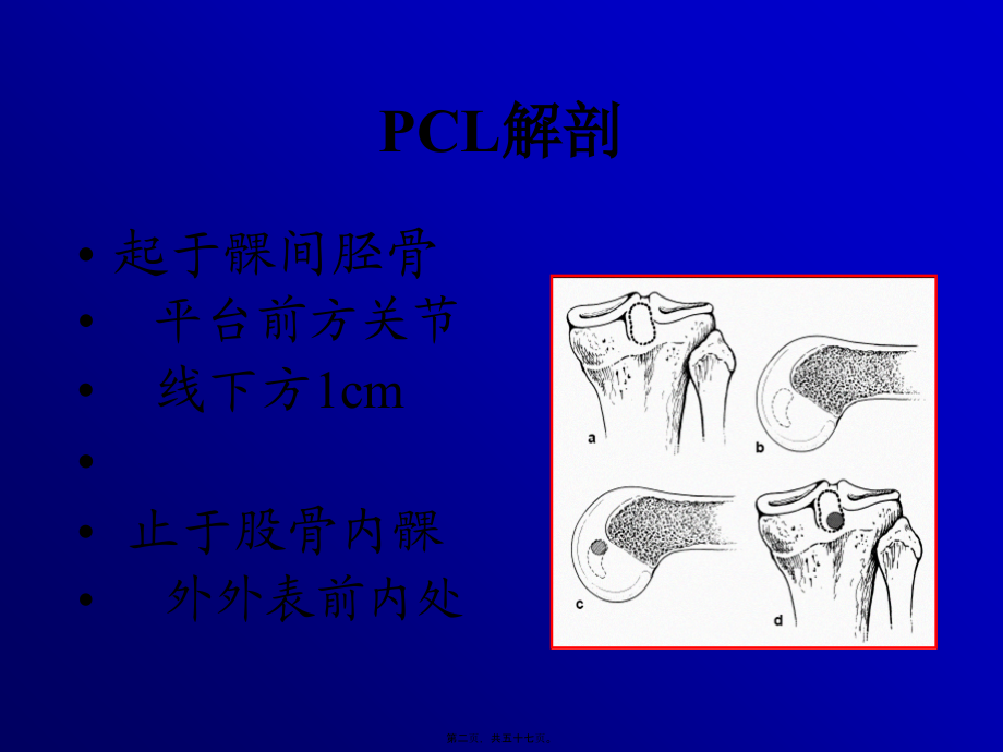 关节镜下的后交叉韧带重建术.pptx_第2页