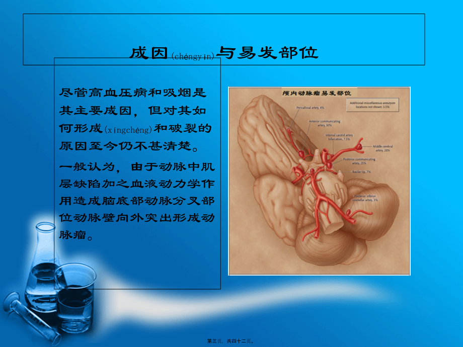 2022年医学专题—珠网膜下腔出血与动脉瘤.ppt_第3页