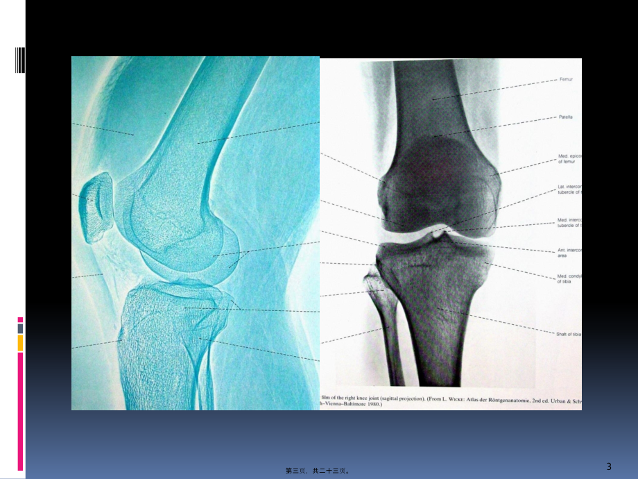 2022年医学专题—膝关节功能康复.pptx_第3页