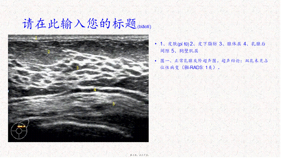 2022年医学专题—乳腺共识.pptx_第3页