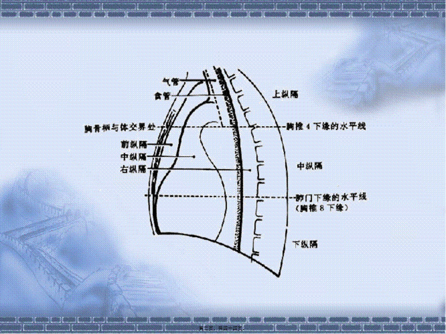 2022年医学专题—纵隔淋巴结CT片.ppt_第2页