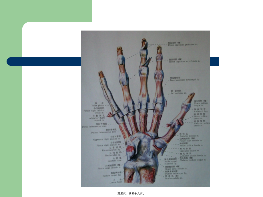 2022年医学专题—第一掌骨基底骨折.ppt_第3页