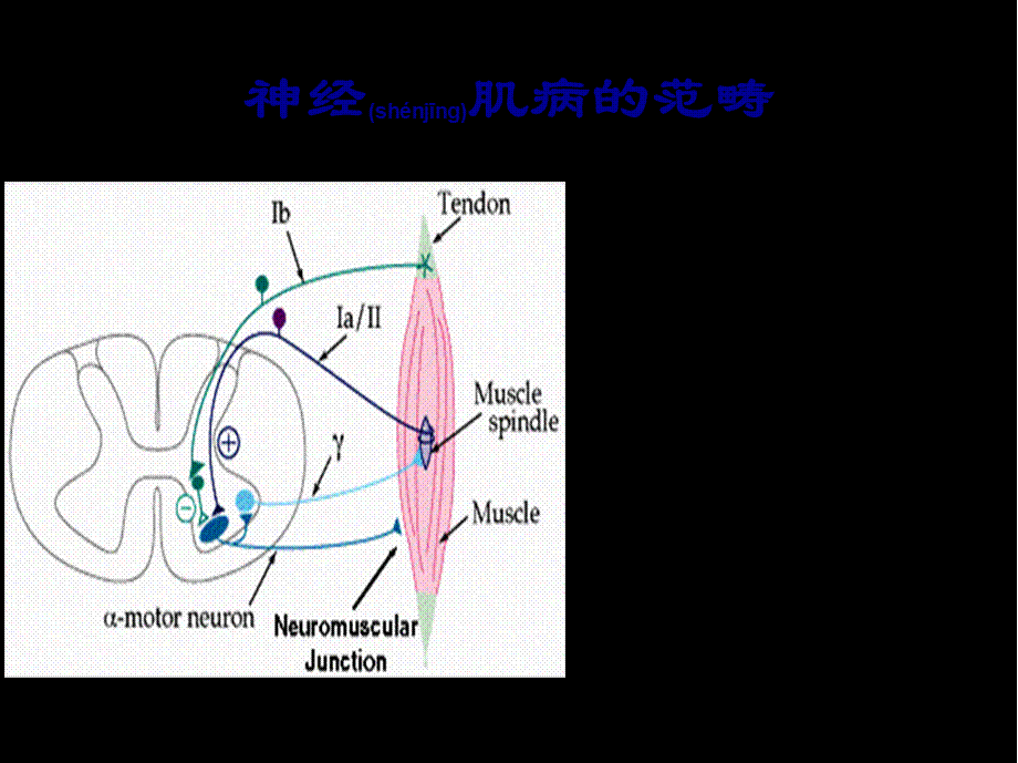 2022年医学专题—神经肌病概述ppt(1).ppt_第2页