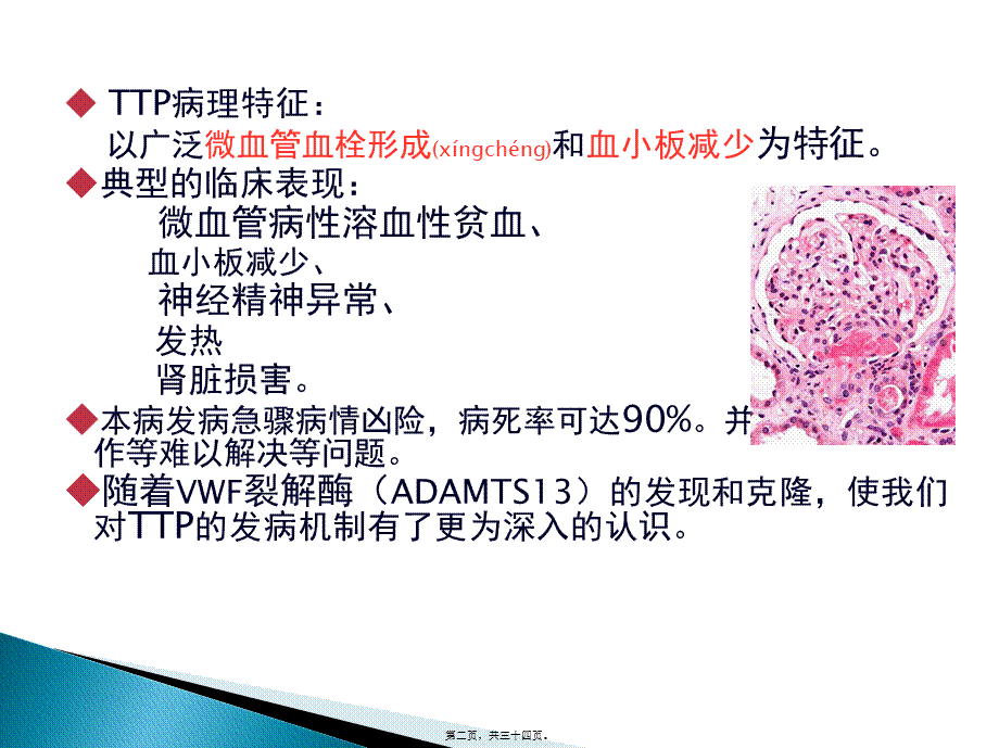 2022年医学专题—TTP诊治住院医师规培(1).ppt_第2页