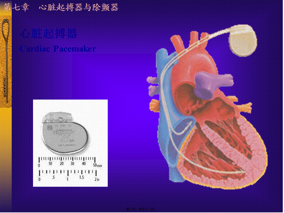 2022年医学专题—心脏起搏器与除颤器(1).ppt_第2页